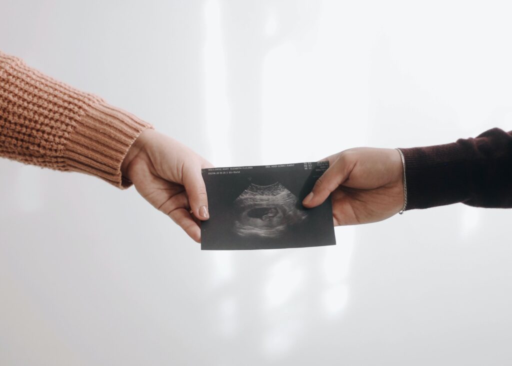 Two hands reaching out and holding a black and white dating sonogram, the first ultrasound that is offered in France during the first trimester of pregnancy (échographie de datation)